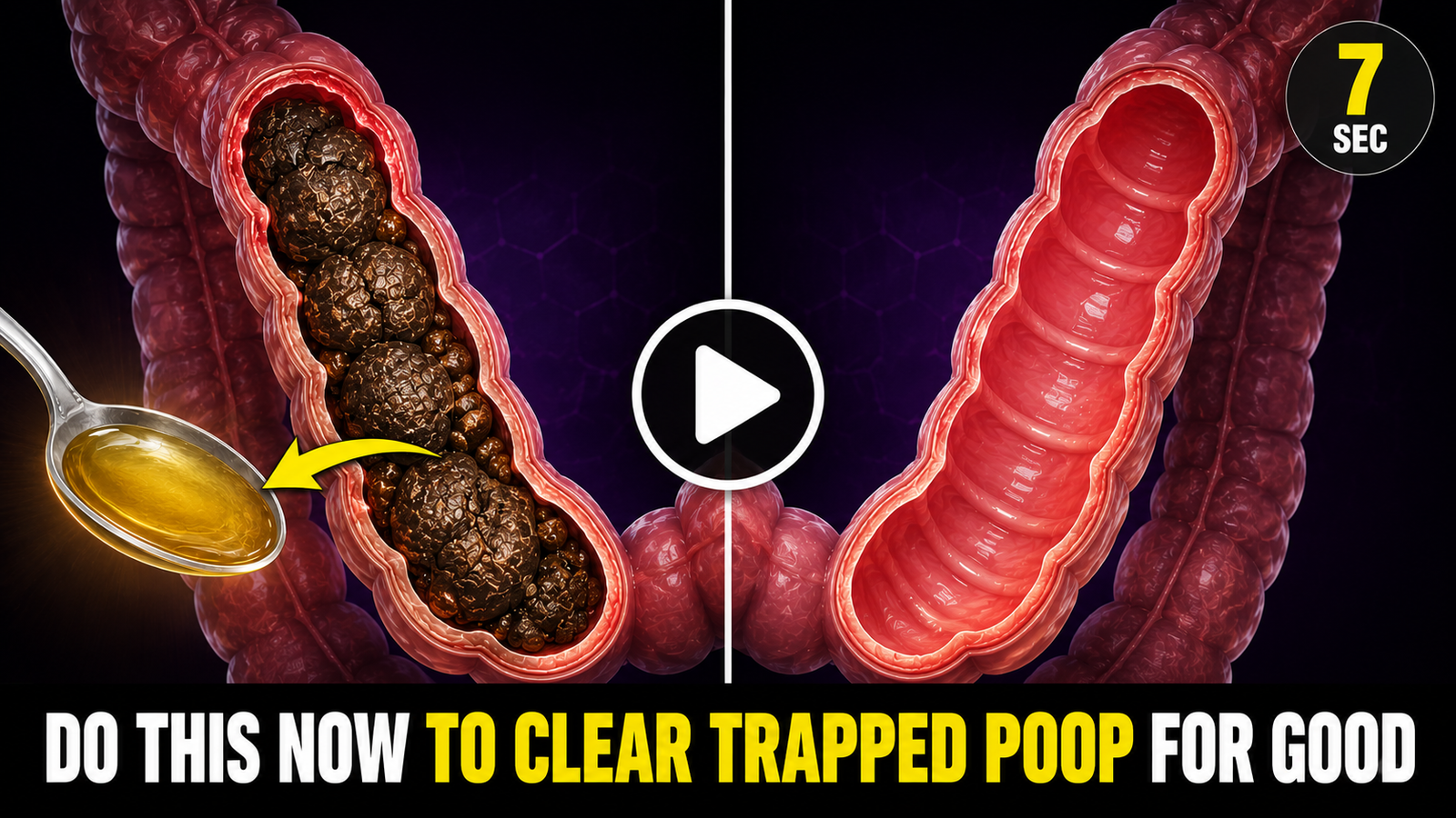 Split diagram of blocked colon with natural remedy versus clear colon after 7-second constipation relief method